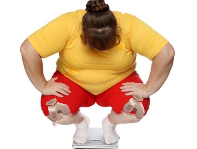 Among patients suffering from arthrosis, the majority are overweight or obese